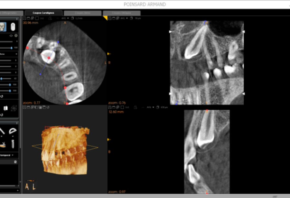 Cone Beam Ct Image Capture - The Best Picture Of Beam